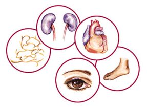 Bodies on which complications of diabetes Melitus